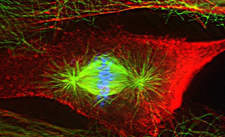 Retinal pigment epithelial cell undergoing division